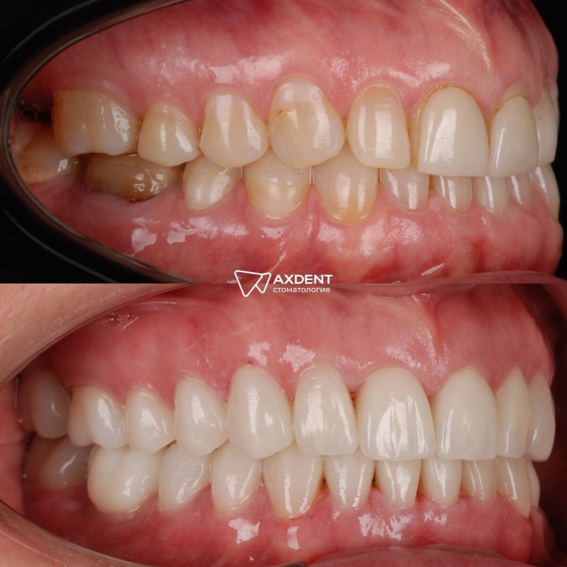 Почему успех в стоматологии зависит от индивидуального подхода